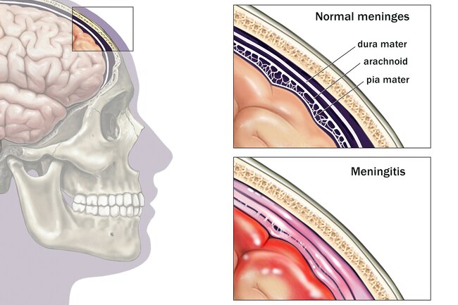 http://medro.org/wp-content/uploads/2020/12/1800ss_medicalimages_rm_brain_meninges_illustration.jpg