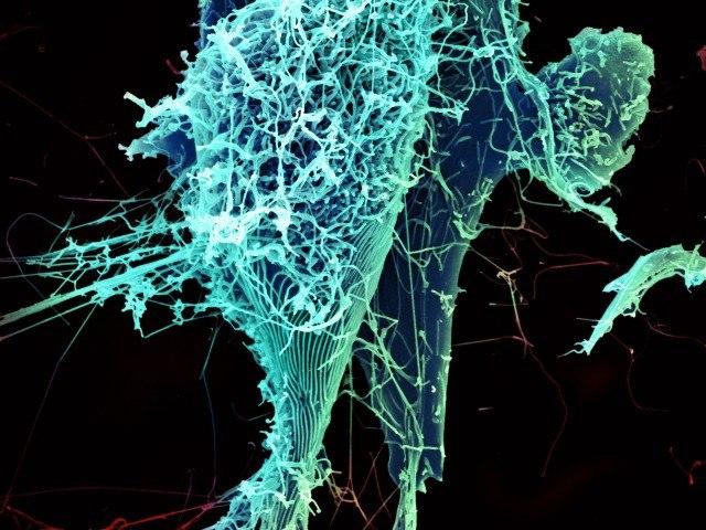 Particulele virusului Ebola