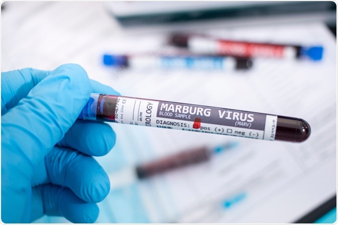Virusul Marburg