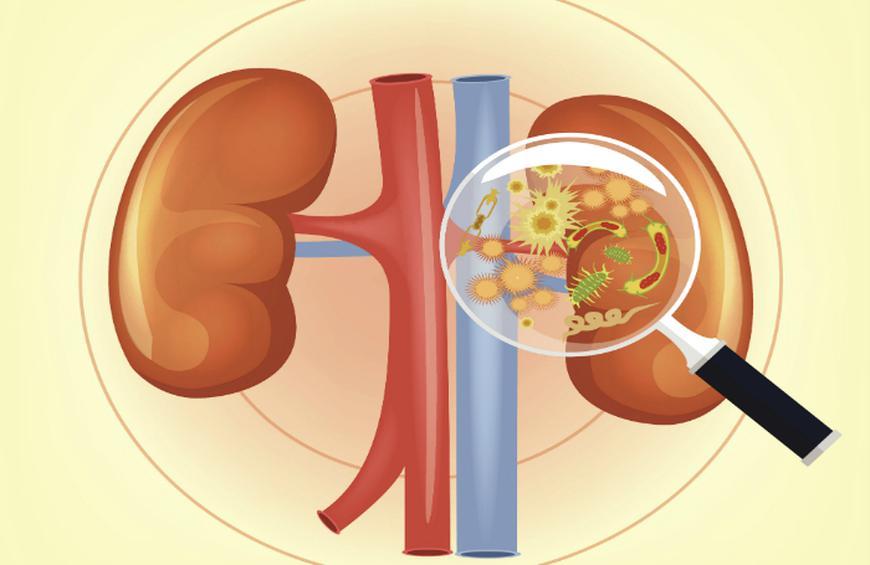 Infecția renală: simptome, cauze și tratament