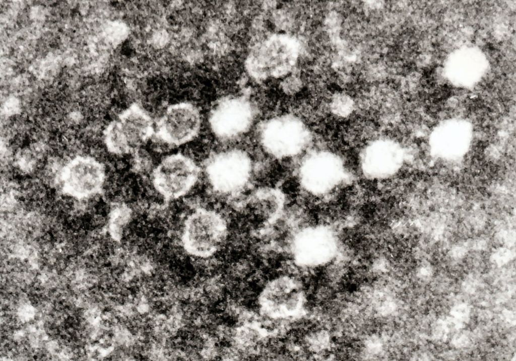 Parvovirus în Blood.jpg
