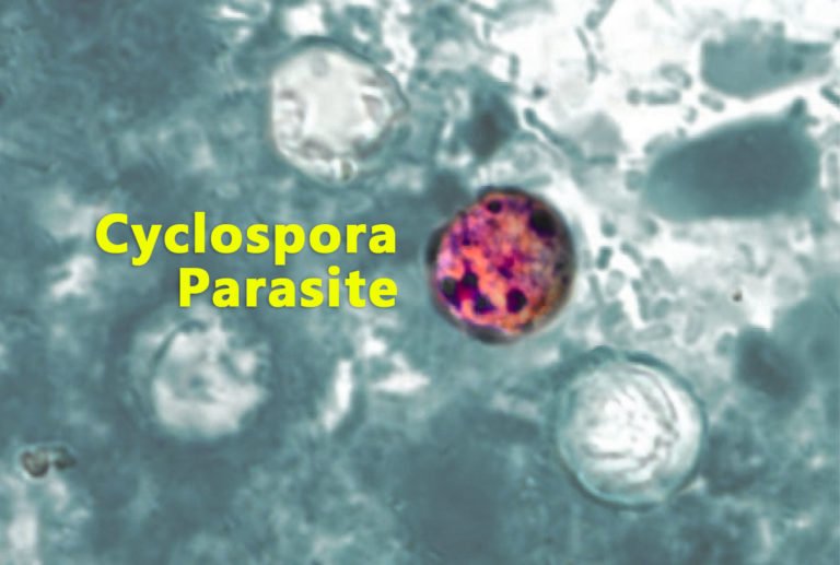 Infecția cu ciclospora: simptome, cauze și tratament