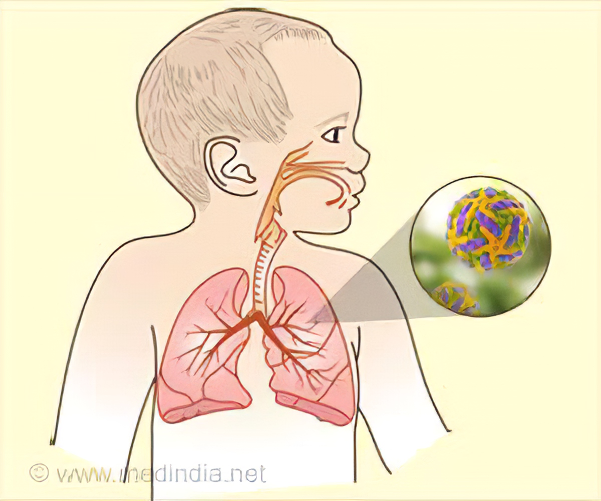 Virusul sincițial respirator (RSV)